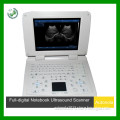 Digital Laptop Ultrasound Scanner